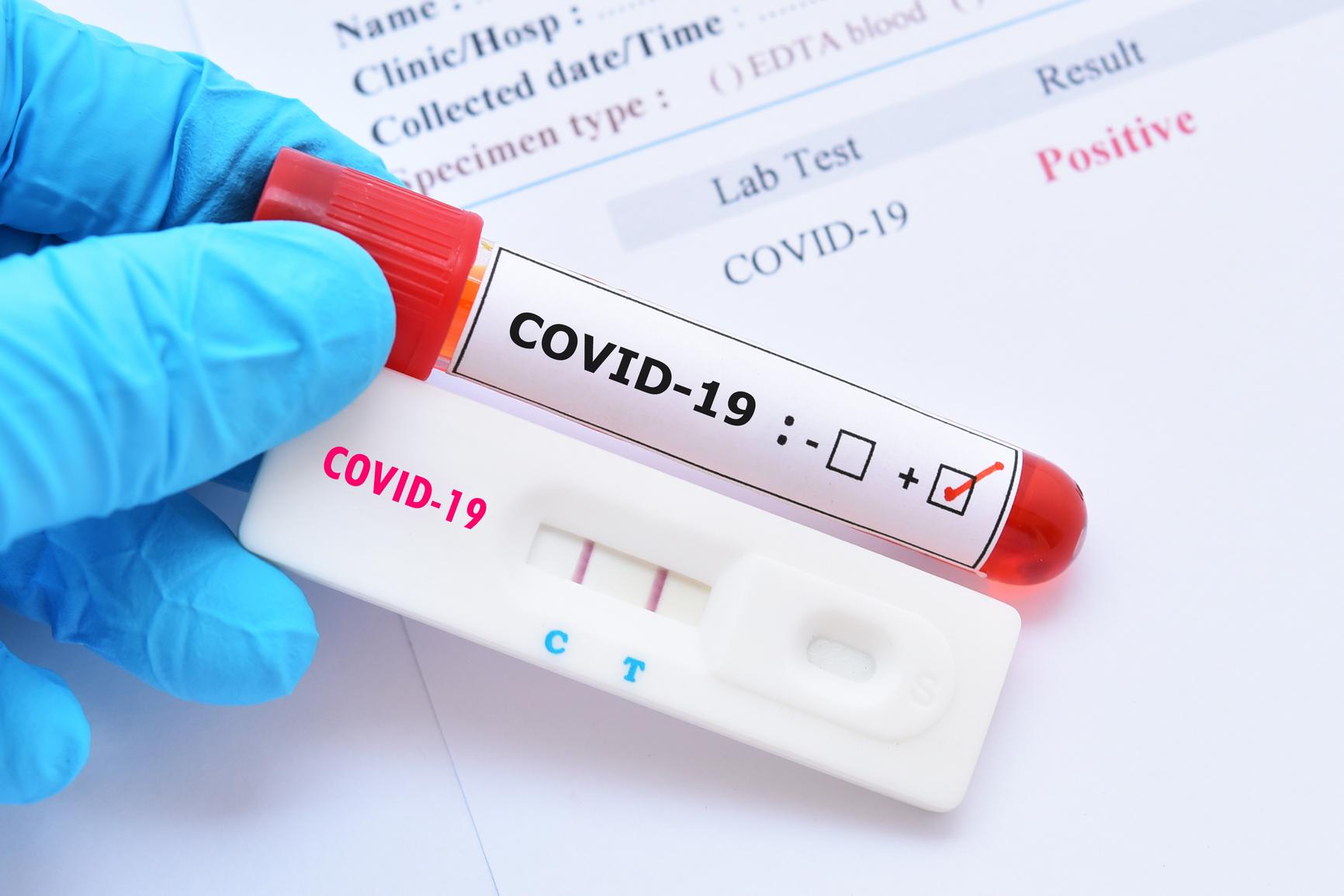 Kakitangan Positif COVID-19, Sebuah Tabika Ditutup