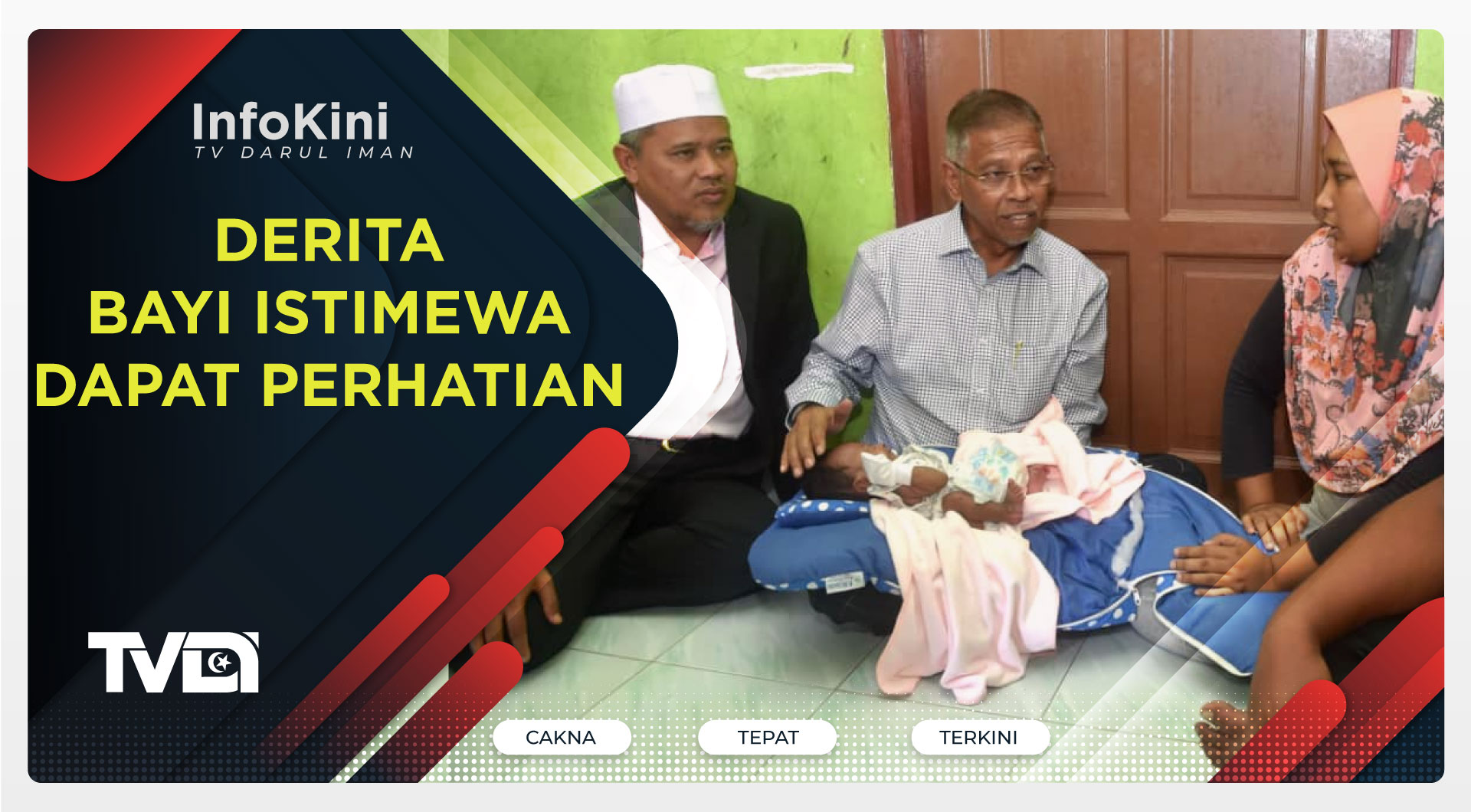 Derita Bayi Istimewa Dapat Perhatian