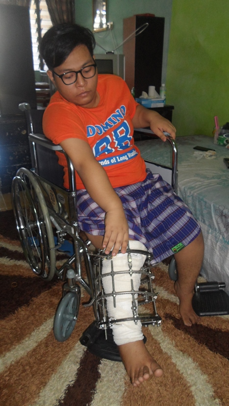 Remaja Tulang Bengkok Terima Bantuan TDI